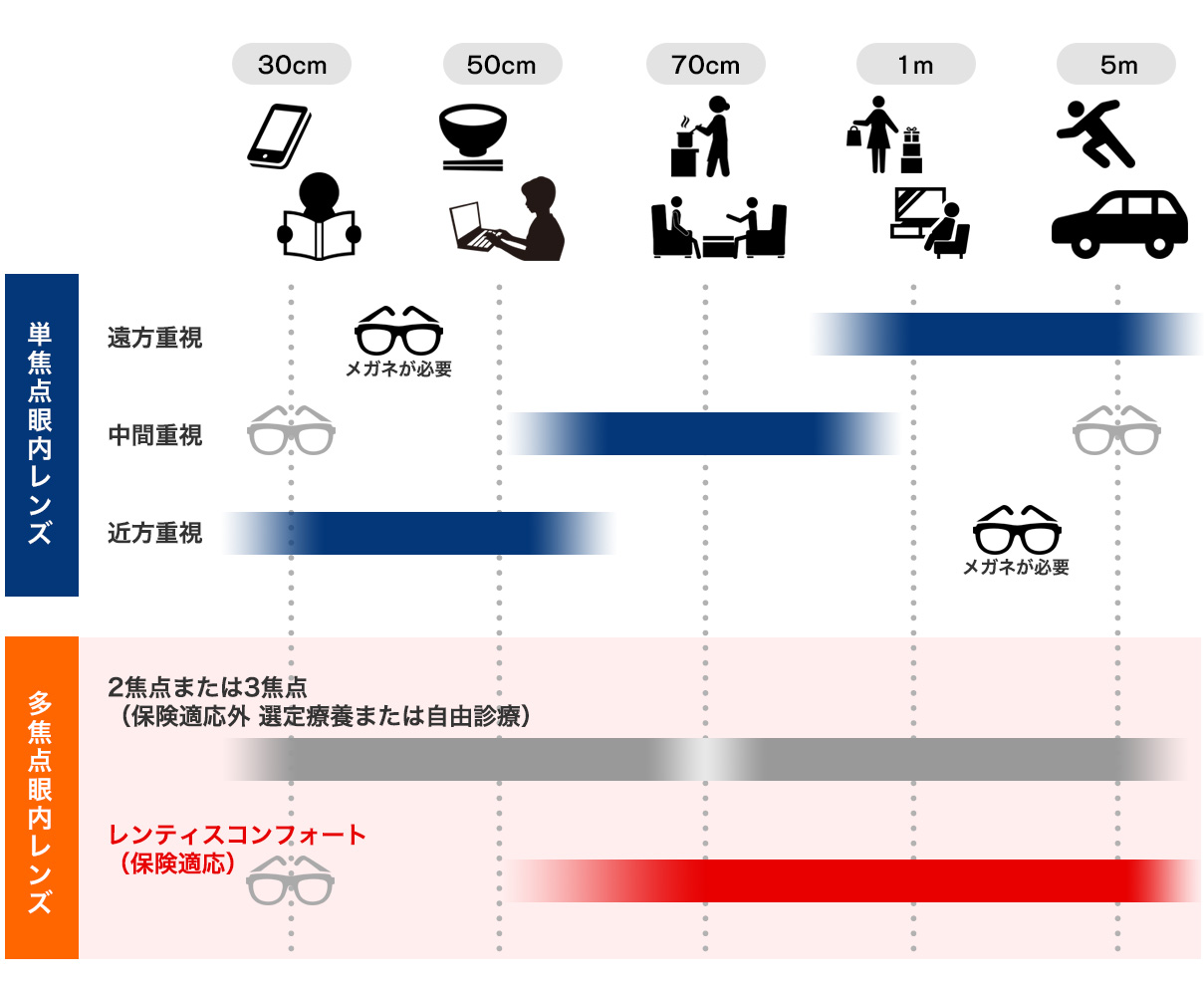 眼内レンズの種類と焦点